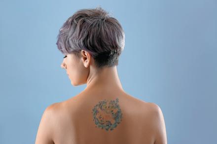 From $120 for 3 Tattoo Removal Sessions