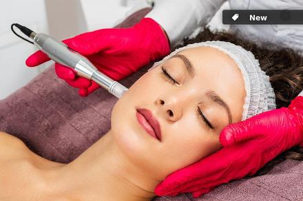 Skin Microneedling with Rejuvenation Mask in Smithfield 