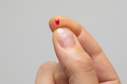 Finger-Prick Blood Spot Intolerance Testing