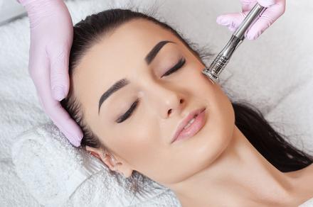 Microdermabrasion Facial Sessions in Brookvale