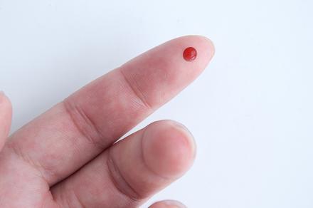 Finger-Prick Blood Spot Intolerance Testing