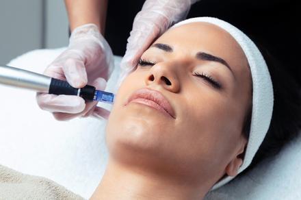 Full-Face Dermapen 3 Skin Needling Sessions in the CBD