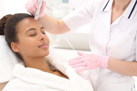 Dermapen Skin Needling Treatments in Cabramatta
