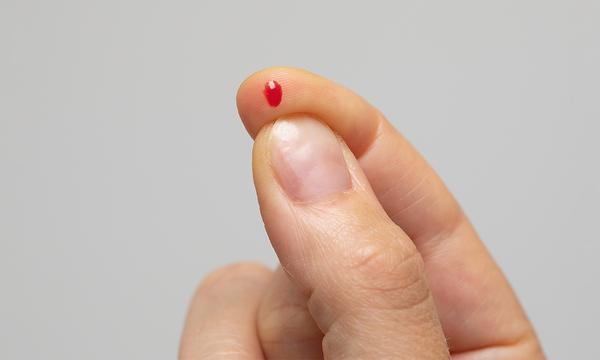 Finger-Prick Blood Spot Intolerance Testing